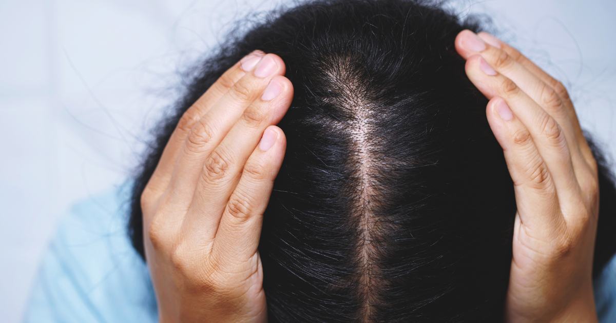 Mulher com cabelo oleoso usando argila vermelha como tratamento capilar